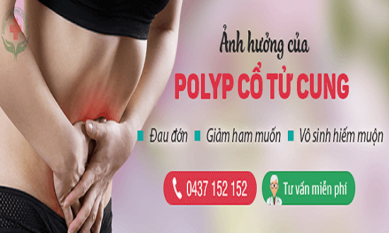 tác hại của polyp cổ tử cung